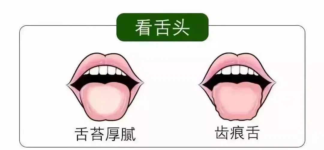 清明時(shí)節(jié)雨紛紛 疏通經(jīng)絡(luò)馬上給身體加分！
